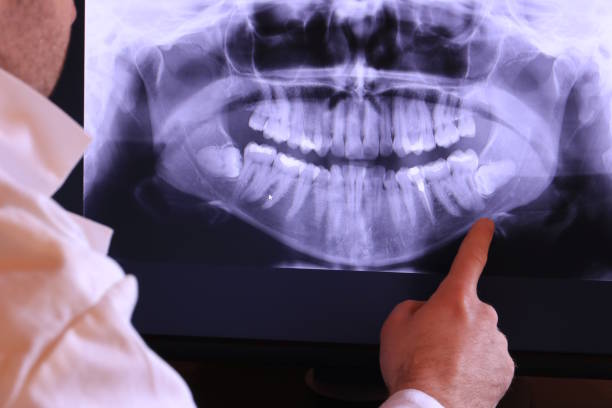 Best Emergency Tooth Extraction in Stedman, NC
