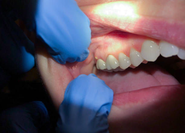 Best Emergency TMJ Treatment in Stedman, NC