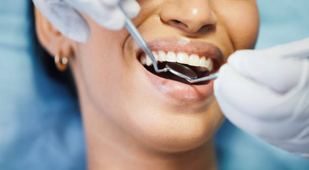 Best Emergency Gum Treatment in Stedman, NC